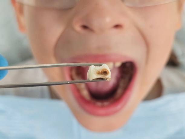Best Emergency Treatment for Toothache in Delafield, WI
